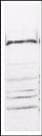 IHC-plus™ IKBKB / IKK2 / IKK Beta Antibody (C-Terminus)