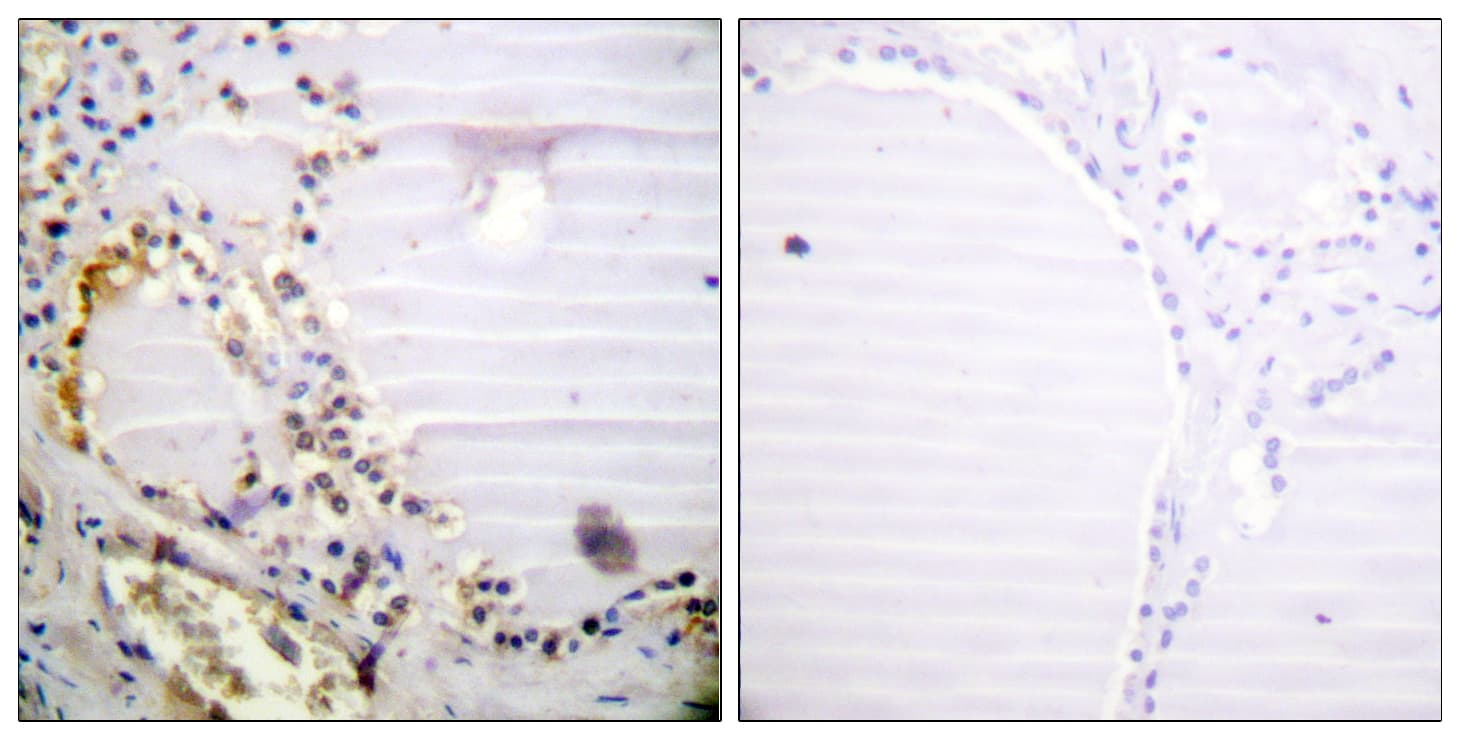 RBBP8 / CTIP Antibody (aa630-679)