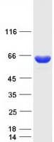 Human KLHL3 Protein (Recombinant Myc-DDK (Flag))