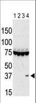 AURKC / Aurora C Antibody (aa115-145)