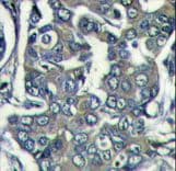 Polyclonal Rabbit anti-Human EIF4E2 / IF4e Antibody (aa12-41, IHC, WB)