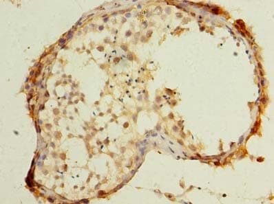 UBXN6 / UBXD1 Antibody