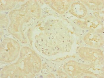 TIMM10B / FXC1 Antibody