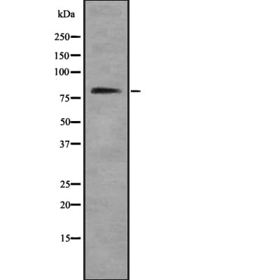 Polyclonal Rabbit anti-Human RGPD8 Antibody (WB)