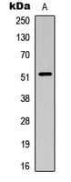 SMAD3 Antibody (phospho-Thr179)