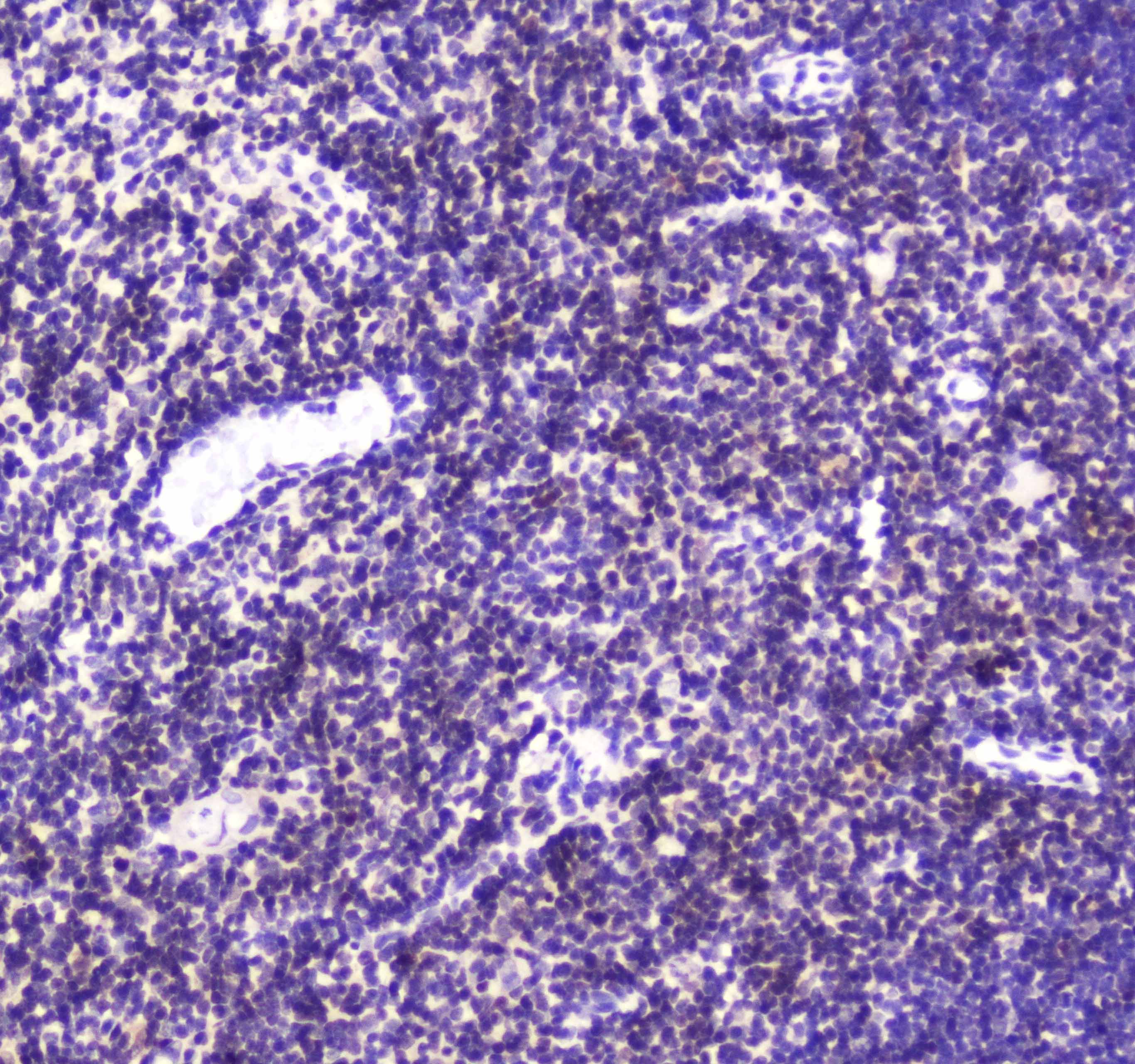 CBFB Antibody