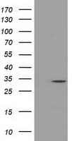 Monoclonal Mouse anti-Human C21orf59 Antibody (clone OTI1A1, IF, WB)