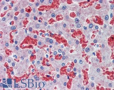 IHC-plus™ Polyclonal Rabbit anti-Human HBB / Hemoglobin Beta Antibody (IHC, WB)