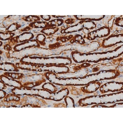 CREB1 / CREB Antibody (phospho-Ser142)