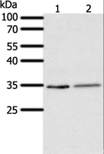 SFTPA1 / Surfactant Protein A Antibody
