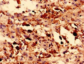 TRPM2 Antibody (aa60-119)