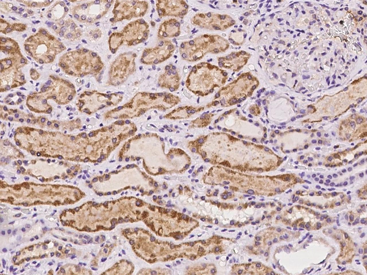CEP55 Antibody