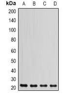 IHC-plus™ Polyclonal Rabbit anti-Human DHFR Antibody (IHC, WB)