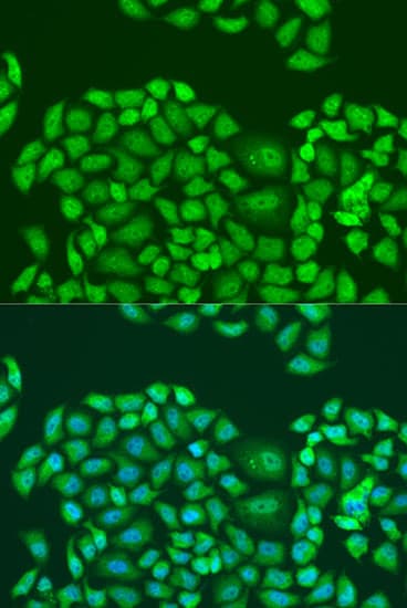 Polyclonal Rabbit anti-Human SMN2 Antibody (IHC, IF, WB)