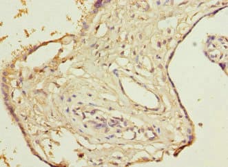 Polyclonal Rabbit anti-Human DCTD / dCMP Deaminase Antibody (IHC)