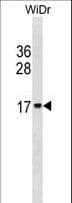 Polyclonal Rabbit anti-Human HIST2H2BE Antibody (aa12-40, WB)