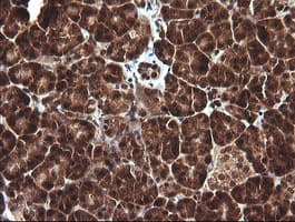 Monoclonal Mouse anti-Human DDT / Dopamine Tautomerase Antibody (clone OTI1A1, IHC, WB)