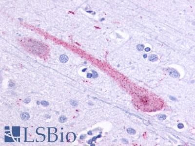 PathPlus™ Polyclonal Rabbit anti-Human OR51E1 Antibody (Cytoplasmic Domain, IHC)