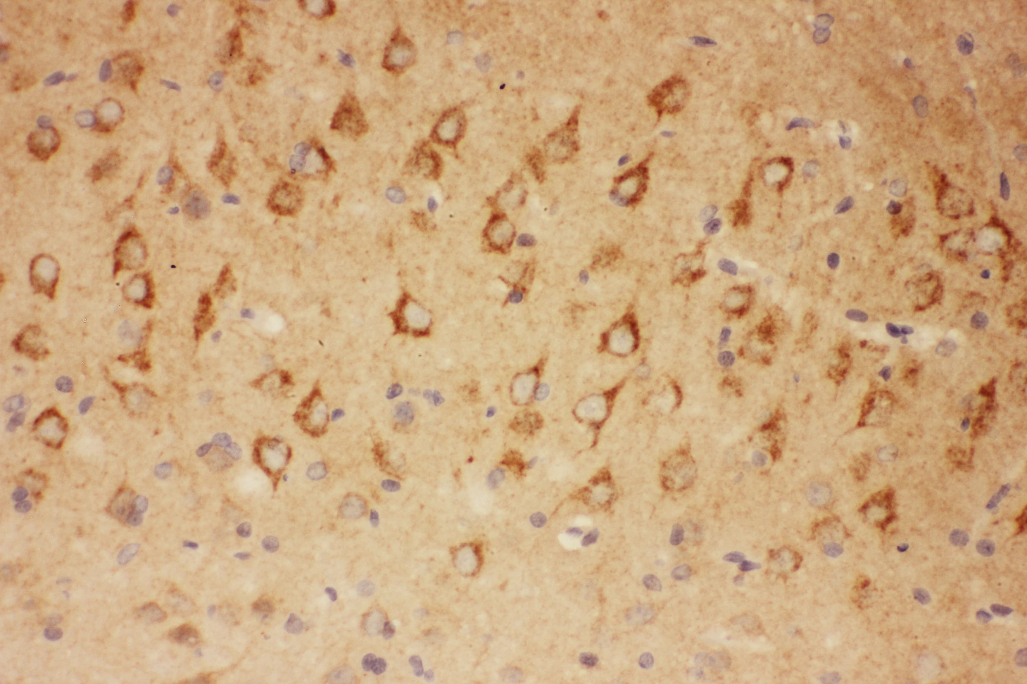 CNTF Antibody (aa2-200)