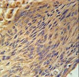 Polyclonal Rabbit anti-Human CPEB4 Antibody (aa109-137, IHC, WB)