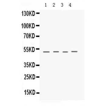 KERA / Keratocan Antibody (aa77-109)