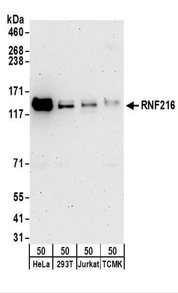 RNF216 / TRIAD3 Antibody (aa100-150)