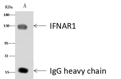 IFNAR1 / IFNAR Antibody (Preservative Free)