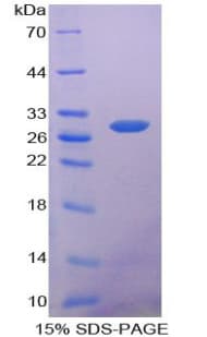 Human PHAP1 / ANP32A Protein (Recombinant His)