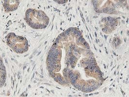 Monoclonal Mouse anti-Human GPR49 / LGR5 Antibody (clone OTI2H7, aa250-550, IHC, IF, WB)