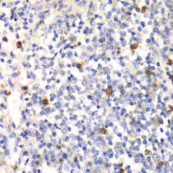 PSMD7 / MOV34 Antibody