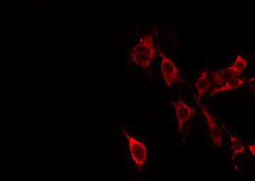 NCAN / Neurocan Antibody