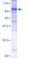 Human SLC4A4 / NBC1 Protein (Recombinant GST)