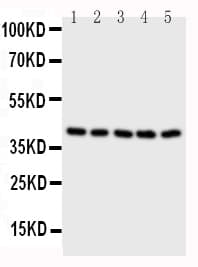 BCAT2 Antibody (aa377-392)