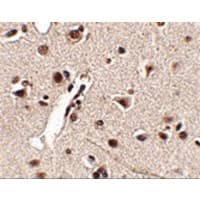 Polyclonal Rabbit anti-Human MEX3A Antibody (IHC, IF, WB)