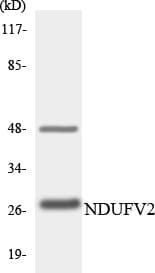 NDUFV2 Antibody (aa3-52)