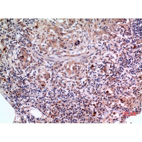 Polyclonal Rabbit anti-Human SERPINB3 Antibody (101-150 aa, Internal, IHC, WB)