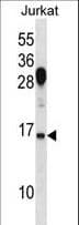 Polyclonal Rabbit anti-Human RHOG / ARHG Antibody (aa99-128, WB)