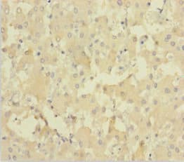 NEIL1 Antibody
