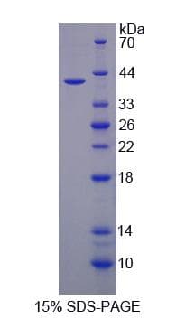 Rat IREB2 / IRP2 Protein (Recombinant 6His, N-terminus)