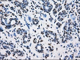 Monoclonal Mouse anti-Human L1CAM Antibody (clone OTI4F4, IHC, IF, WB)