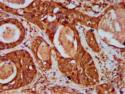 Polyclonal Rabbit anti-Human WIPF2 / WIRE Antibody (IHC)
