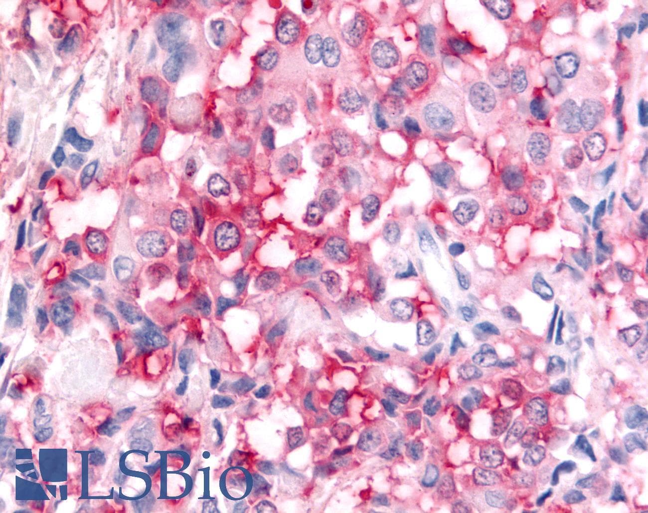 PathPlus™ ADAMTS5 Antibody (Metalloprotease Domain)