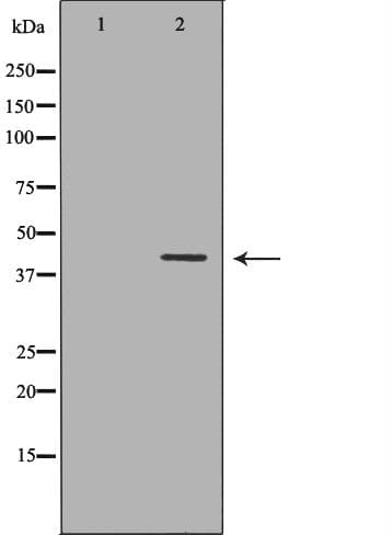 MURF1 / IRF Antibody