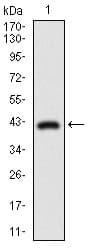 Monoclonal Mouse anti-Human DNM1L / DRP1 Antibody (clone 4E11B11, aa69-213, IHC, WB)