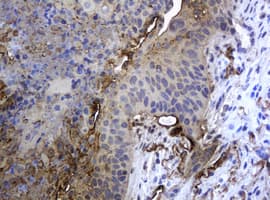 KRT5 / CK5 / Cytokeratin 5 Antibody (aa1-273, clone OTI1E7)