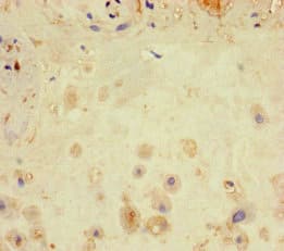 Polyclonal Rabbit anti-Human LATS1 Antibody (IHC, IF)