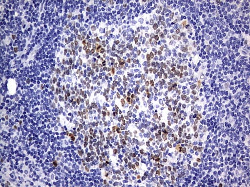 TOP2A / Topoisomerase II Alpha Antibody (aa1100-1531, clone OTI19D4)