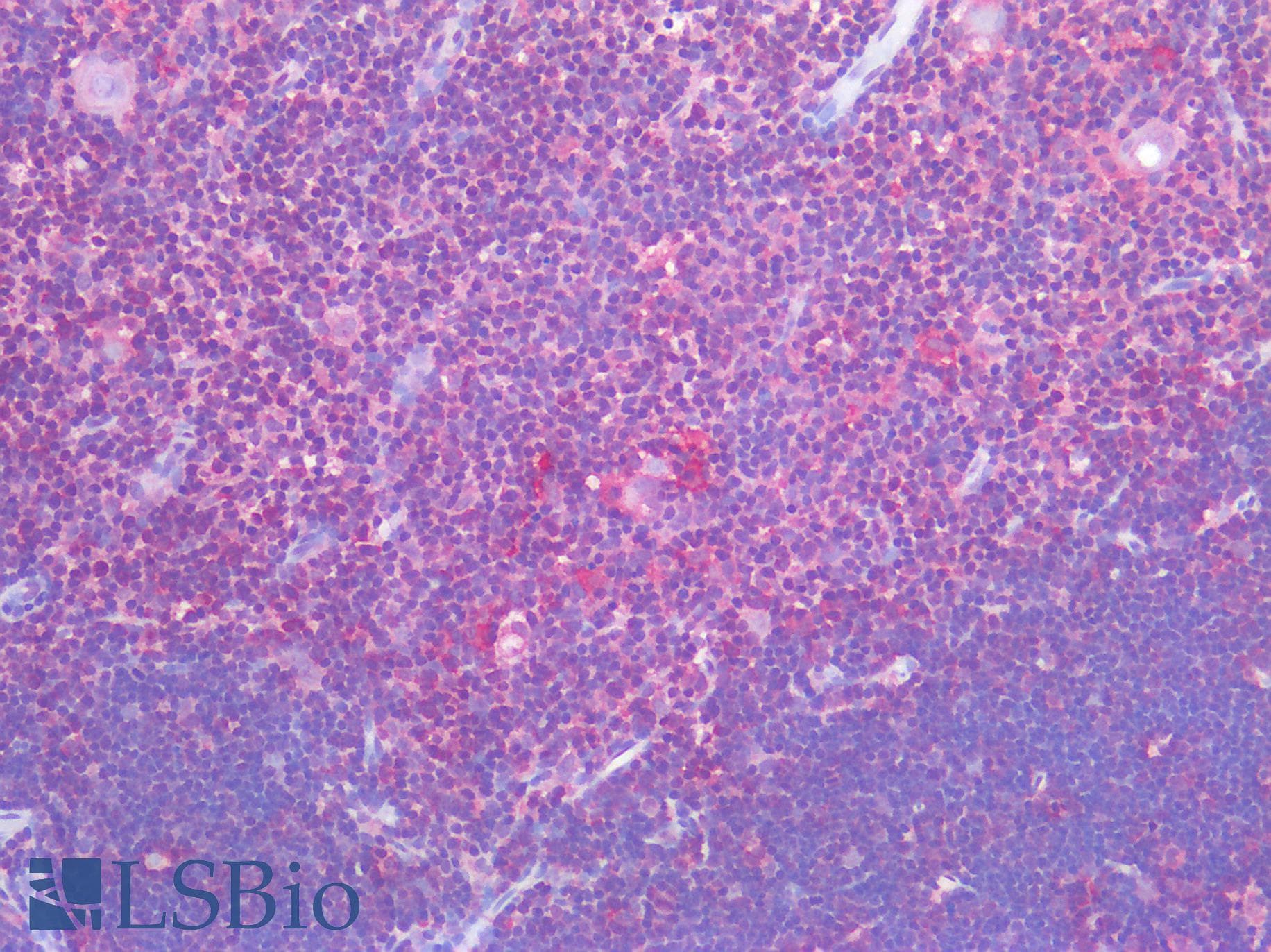 IHC-plus™ PARP1 Antibody