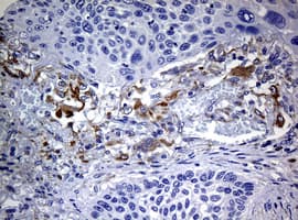 Monoclonal Mouse anti-Human Tyrosinase Antibody (clone OTI1F3, IHC, WB)