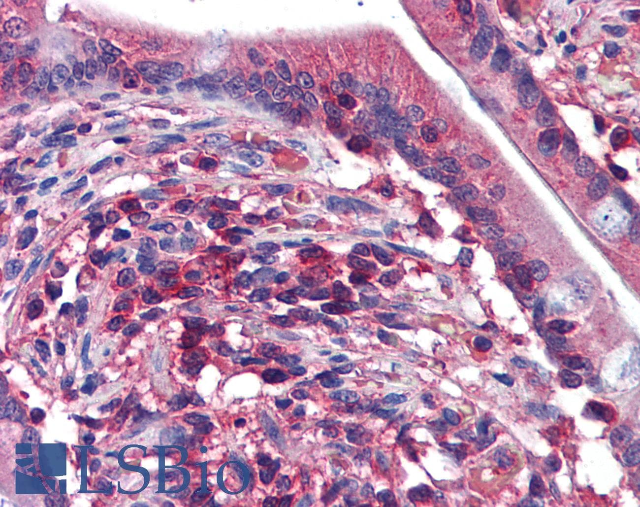 IHC-plus™ HEDLS / EDC4 Antibody (clone 2E2)